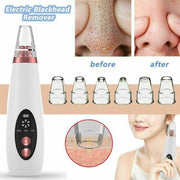 Blackhead Black Dot Remover