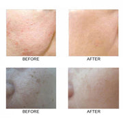 Double Side Silicone Face Cleanser Brush